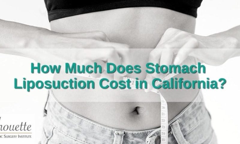 How Much Is It To Get Lipo